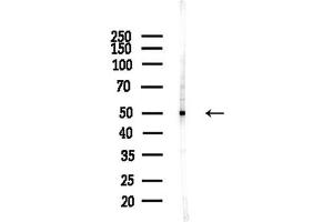 anti-Distal-Less Homeobox 3 (DLX3) (Internal Region) antibody