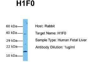 Host: Rabbit Target Name: H1F0 Sample Tissue: Human Fetal Liver Antibody Dilution: 1. (Histone H1 Antikörper  (N-Term))