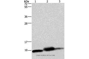 Western blot analysis of Mouse heart, human fetal liver and hepatocellular carcinoma tissue,, using COX6B1 Polyclonal Antibody at dilution of 1:1150 (COX6B1 Antikörper)