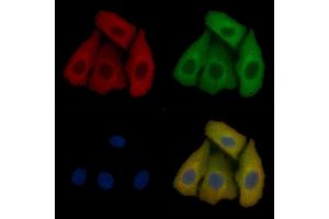 TUSC1 Mouse Monoclonal Antibody staining Hela cells by IF/ICC.