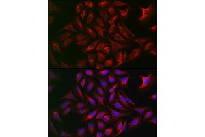 Immunofluorescence analysis of U2OS cells using  Rabbit pAb (ABIN7265789) at dilution of 1:50 (40x lens). (ATG12 Antikörper  (AA 1-74))
