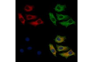 ABIN7093853 and ABIN7097896 staining HepG2 cells by IF/ICC. (CTPS2 Antikörper  (C-Term))