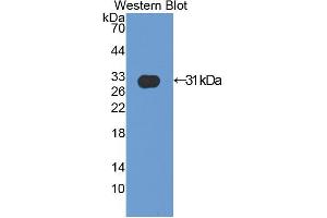 Western blot analysis of the recombinant protein. (ACTN2 Antikörper  (AA 1-254))