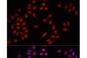 Immunofluorescence analysis of HeLa cells using PRDM14 Polyclonal Antibody at dilution of 1:100. (PRDM14 Antikörper)