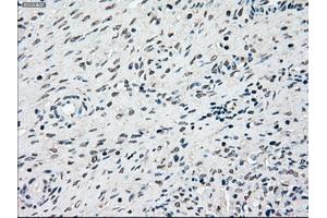 Immunohistochemical staining of paraffin-embedded lung tissue using anti-SSBmouse monoclonal antibody. (SSB Antikörper)