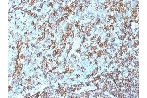 Immunohistochemistry (IHC) image for anti-Major Histocompatibility Complex, Class II, DR beta 1 (HLA-DRB1) antibody (ABIN6939640)