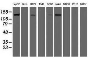 Image no. 2 for anti-Histone Deacetylase 6 (HDAC6) antibody (ABIN1498618) (HDAC6 Antikörper)