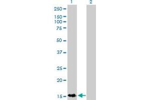 Western Blot analysis of S100A9 expression in transfected 293T cell line by S100A9 monoclonal antibody (M13), clone 1C22.