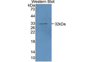 Detection of Recombinant AIM1, Human using Polyclonal Antibody to Absent In Melanoma 1 (AIM1) (AIM1 Antikörper  (AA 1502-1719))