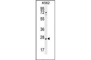 Western blot analysis of hCG_2024410 Antibody (C-term) in K562 cell line lysates (35ug/lane). (hCG_2024410 (AA 187-215), (C-Term) Antikörper)