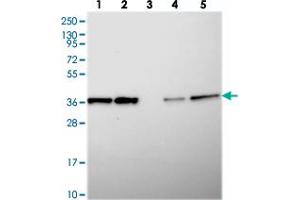 Western blot analysis of Lane 1: RT-4, Lane 2: U-251 MG, Lane 3: Human Plasma, Lane 4: Liver, Lane 5: Tonsil with CHORDC1 polyclonal antibody  at 1:250-1:500 dilution. (CHORDC1 Antikörper)