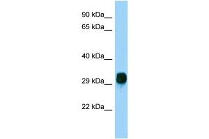 Host: Rabbit Target Name: FBXO17 Sample Type: HepG2 Whole Cell lysates Antibody Dilution: 1. (FBXO17 Antikörper  (N-Term))