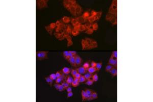 Immunofluorescence (IF) image for anti-Cystic Fibrosis Transmembrane Conductance Regulator (ATP-Binding Cassette Sub-Family C, Member 7) (CFTR) (AA 1161-1480) antibody (ABIN6138469)