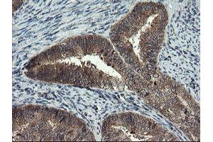 Image no. 2 for anti-Myeloid Leukemia Factor 1 (MLF1) antibody (ABIN1499496) (MLF1 Antikörper)