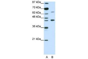 RARA antibody used at 1. (Retinoic Acid Receptor alpha Antikörper  (N-Term))