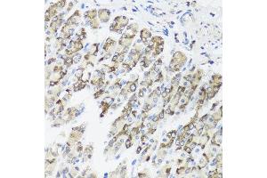Immunohistochemistry of paraffin-embedded mouse stomach using TIMM10B antibody at dilution of 1:100 (x40 lens). (TIMM10B Antikörper)