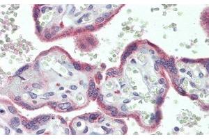 Immunohistochemistry (IHC) image for anti-phospholipase A2 Receptor 1, 180kDa (PLA2R1) (AA 1418-1487) antibody (ABIN7443389)