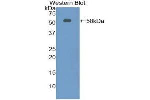 Detection of Recombinant Ntn1, Rat using Polyclonal Antibody to Netrin 1 (Ntn1) (Netrin 1 Antikörper  (AA 313-565))