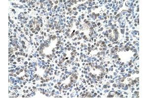 MCM3 antibody was used for immunohistochemistry at a concentration of 4-8 ug/ml to stain Alveolar cells (arrows) in Human Lung. (MCM3 Antikörper  (C-Term))