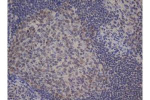 Image no. 1 for anti-B-Cell CLL/lymphoma 10 (BCL10) antibody (ABIN1496848) (BCL10 Antikörper)