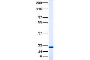 Validation with Western Blot (TNFRSF11A Protein)