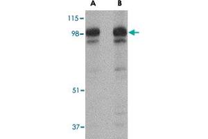 Western blot analysis of SLITRK2 in rat brain tissue lysate with SLITRK2 polyclonal antibody  at (A) 1 and (B) 2 ug/mL . (SLITRK2 Antikörper  (C-Term))