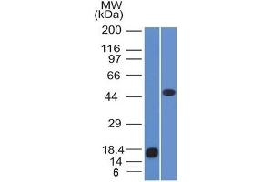 Western Blot of recombinant Adipophilin and Jurkat cell lysate using Adipophilin Mouse Monoclonal Antibody (ADFP/1365). (ADRP Antikörper  (AA 249-376))