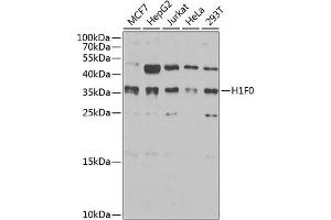 Western blot analysis of extracts of various cell lines, using Histone H1. (Histone H1 Antikörper  (AA 1-194))