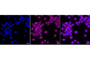 Immunocytochemical staining of HeLa cells with P70 S6 Kinase beta antibody (ABIN7800226), 1:1,000). (Rekombinanter RPS6KB2 Antikörper)