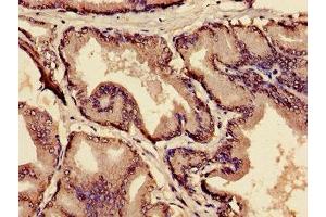 Immunohistochemistry of paraffin-embedded human prostate tissue using ABIN7159300 at dilution of 1:100 (MIA Antikörper  (AA 87-124))