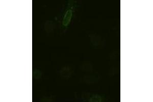 Anti-IL-6 mouse monoclonal antibody (ABIN2452353) immunofluorescent staining of HeLa cells transiently transfected by pCMV6-ENTRY IL-6 (RC202078) (IL-6 Antikörper  (AA 29-212))