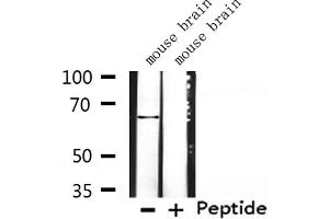 Western blot analysis of extracts from mouse brain, using K2C3 Antibody. (Keratin 3 Antikörper  (C-Term))