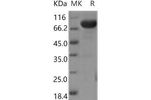 Western Blotting (WB) image for CD5 (CD5) protein (Fc Tag) (ABIN7321103)