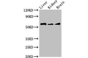 Western Blot Positive WB detected in: Mouse liver tissue, Mouse kidney tissue, Mouse brain tissue All lanes: CHRM5 antibody at 3. (CHRM5 Antikörper  (AA 220-427))