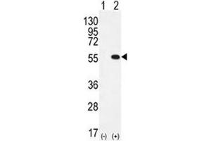 Western blot analysis of PRMT2 antibody and 293 cell lysate either nontransfected (Lane 1) or transiently transfected (2) with the PRMT2 gene. (PRMT2 Antikörper  (AA 344-375))
