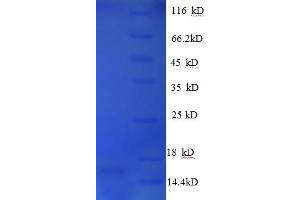 SDS-PAGE (SDS) image for Growth Differentiation Factor 15 (GDF15) (AA 198-308) protein (His tag) (ABIN5712714)