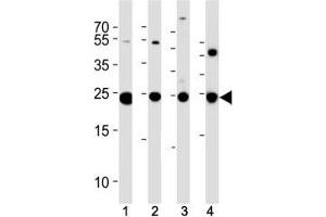 PGP 9. (UCHL1 Antikörper  (AA 187-214))