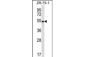 SEC62 Antibody (N-term) (ABIN656777 and ABIN2845996) western blot analysis in ZR-75-1 cell line lysates (35 μg/lane). (SEC62 Antikörper  (N-Term))