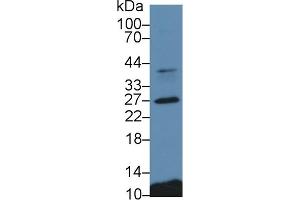 Detection of CTSS in Porcine Spleen lysate using Polyclonal Antibody to Cathepsin S (CTSS) (Cathepsin S Antikörper  (AA 115-331))
