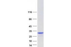 Validation with Western Blot (CT45A1 Protein (Myc-DYKDDDDK Tag))