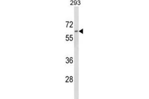 Western Blotting (WB) image for anti-Dolichol Kinase (DOLK) antibody (ABIN3003934) (Dolichol Kinase Antikörper)