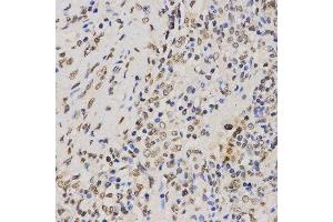 Immunohistochemistry (IHC) image for anti-Histone H3 (H3) (H3K79me3) antibody (ABIN3023275)