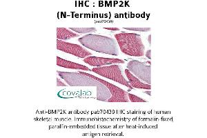 Image no. 2 for anti-BMP2 Inducible Kinase (BMP2K) (N-Term) antibody (ABIN1732361) (BMP2K Antikörper  (N-Term))