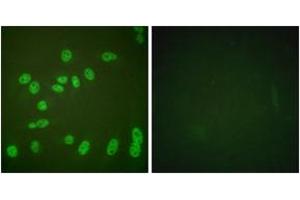 Immunofluorescence analysis of HeLa cells treated with PMA 125ng/ml 30', using POLR2A (Phospho-Ser1619) Antibody. (POLR2A/RPB1 Antikörper  (pSer1619))