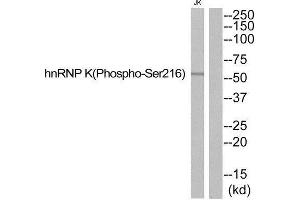 Western Blotting (WB) image for anti-Heterogeneous Nuclear Ribonucleoprotein K (HNRNPK) (pSer216) antibody (ABIN1847784) (HNRNPK Antikörper  (pSer216))