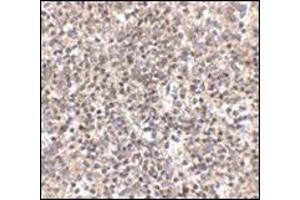 Immunohistochemistry of RSPO1 in human spleen tissue with this product at 2. (RSPO1 Antikörper  (N-Term))
