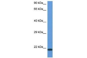 Western Blot showing CD70 antibody used at a concentration of 1 ug/ml against ACHN Cell Lysate (CD70 Antikörper  (N-Term))