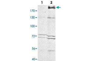Western blot analysis of Mrc1 in whole cell extracts. (Macrophage Mannose Receptor 1 Antikörper)