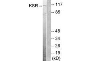 Western blot analysis of extracts from NIH-3T3 cells, treated with PDGF 50ng/ml 20', using KSR (Ab-392) Antibody.