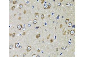 Immunohistochemistry of paraffin-embedded Rat brain using RPS10 Polyclonal Antibody at dilution of 1:100 (40x lens).